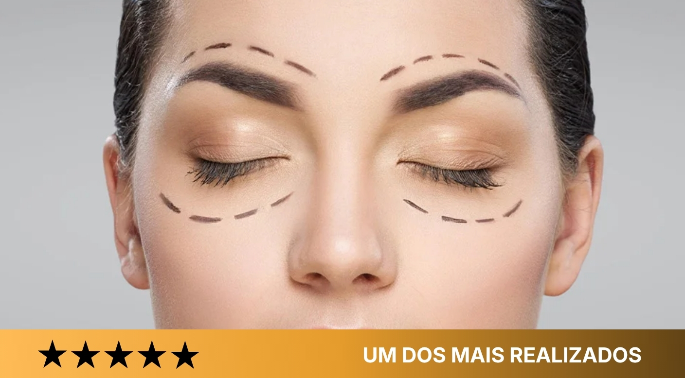 Blefaroplastia (Pálpebras)