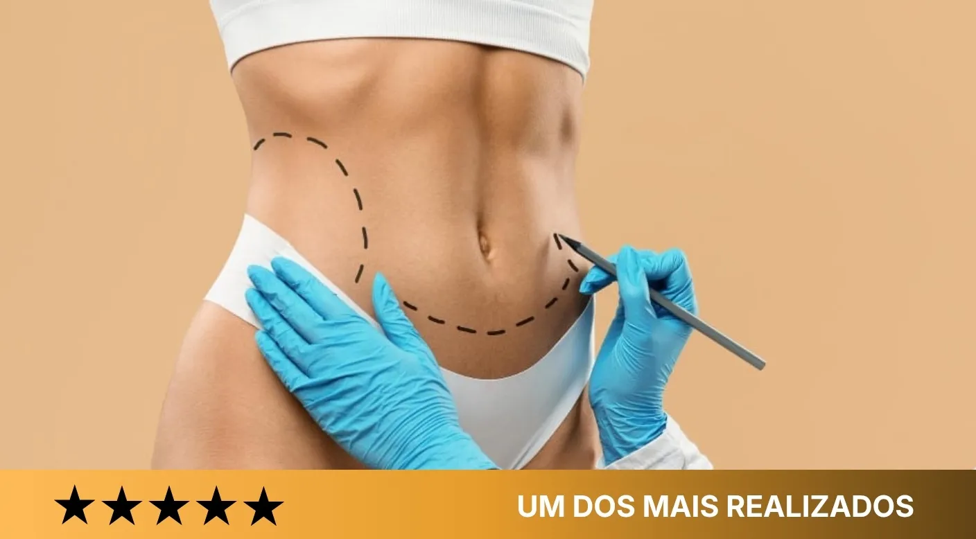 Abdominoplastia