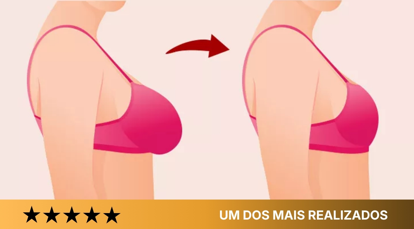 Redução de Mama